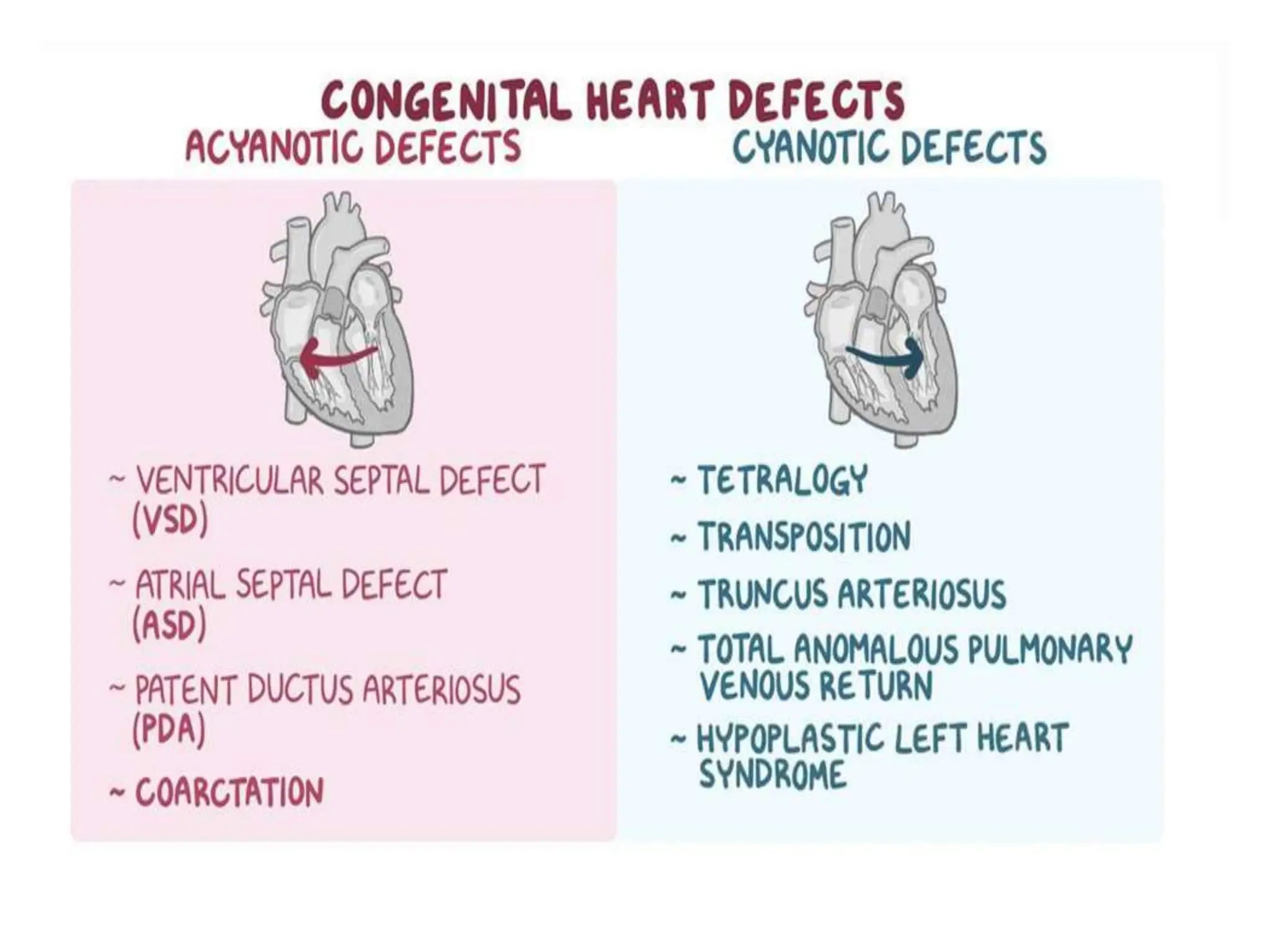 congenital Heart Defects.PDA,ASD,VSD,TGApptx | PPTX