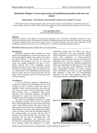 Original Research Article DOI: 10.18231/2456-8953.2018.0003
Indian Journal of Conservative and Endodontics, January-March, 2018;3(1):11-13 11
Endodontic Enigma: A case report series of mandibular premolars with two root
canals
Shalini Singh1,*
, Nitin Mirdha2
, Mariam Belim3
, Roshni Arora4
, Rahul VC Tiwari5
1,3,4
Postraduate Student, 2
Associate Professor, Dept. of Conservative Dentistry and Endodontics, Vyas Dental College and
Hospital, Jodhpur, Rajasthan, 5
FOGS, OMFS, Jubilee Mission Medical College, Hospital &Research Institute, Thrissur, Kerala,
India
*Corresponding Author:
Email: drshalinisingh27@gmail.com
Abstract
Endodontic treatment success depends on biomechanical preparation and 3-D obturation. Mandibular premolars have been
reported with aberrant anatomy. The endodontic treatment of mandibular premolars may have major failure due to unrecognized
or untreated multiple canals when they are present. Hence a thorough knowledge of the root canal morphology, careful
radiographic interpretation and access cavity modifications are essentials for enhancing endodontic procedures.
Keywords: Mandibular premolars, multiple canals, root canal treatment.
Introduction
Mandibular premolars show aberrant root canal
anatomy and morphology. If all the root canals are not
located and properly treated, cases could result in flare-
ups and/or failures1
. It was reported that 24.2% of
mandibular first premolars have two or more root
canals, and multiple foramina at the apex is 20%.2
Seelig3
reported that 97.5% mandibular second
premolar had only one root canal at the apex and only
2.5% had two canals, whereas three root canals are rare.
It is reported that 5.3% of mandibular second premolar
had two canals with two foramen and 44% had two
canals with one foramen, and 0.4-5% had three canals
with three foramen.4
Case Report 1
A 30 year old patient reported to Department of
Conservative dentistry and Endodontics with the chief
complaint of pain in relation to right back region of
mandible. Proper clinical examination was done and
case history was taken. Clinical examination revealed
deep proximal caries in mandibular right second
premolar, and on thorough evaluation of diagnostic
radiograph two canals were observed (Fig. 1A). A
diagnosis of irreversible pulpitis was established.
The tooth was anaesthetized followed by rubber
dam (Hygenic) isolation. Access cavity was prepared
using a round diamond bur in a high speed airotar hand
piece. A sharp DG16 explorer was used to locate the
canal orifices, and the access was modified accordingly.
Pulp extirpation was done, after checking the patency
of the two canals, with# 10K file (Dentsply-Maillefer),
the working length was assessed with the help of
electronic apex locator (Propex II), and further it was
confirmed with the help of radiograph (Fig. 1B).
Biomechanical preparation was performed using
ProTaper File system (Dentsply-Maillefer) with crown-
down technique. During the preparation 5% sodium
hypochlorite solution and 17% EDTA was used as
irrigant alternatively after every instrument change.
Apical Preparation was done till F2 size for both the
canals, after completion of chemo-mechanical
preparation closed dressing was given and patient was
reappointed after 3 days for obturation. In follow-up
appointment as the tooth was completely asymptomatic
master cone radiograph was taken (Fig. 1C). The canals
were dried using paper point. Obturation was done
using corresponding ProTaper F2 cones; sealapex
(Kerr, SybronEndo) was used as a sealer. Radiograph
after obturation is taken (Fig. 1D). Post-obturation
restoration was done using composite (Filtek Z250,
3M) and post-operative radiograph was taken (Fig. 1E).
Fig. 1A: Pre-operative diagnostic radiograph
Fig. 1B: Working length confirmation radiograph
 
