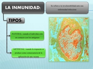 LA INMUNIDAD: 
Se refiere a la invulnerabilidad ante una 
enfermedad infecciosa 
TIPOS: 
ARTIFICIAL: cuando la respuesta se 
produce como consecuencia de la 
aplicación de una vacuna 
 