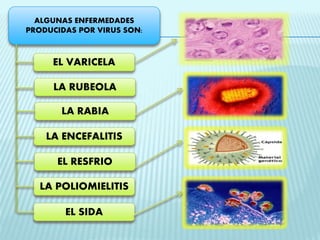 ALGUNAS ENFERMEDADES 
PRODUCIDAS POR VIRUS SON: 
EL VARICELA 
LA RUBEOLA 
LA RABIA 
LA ENCEFALITIS 
EL RESFRIO 
LA POLIOMIELITIS 
EL SIDA 
 