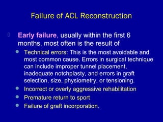 34. acl injuries