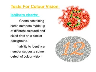 34. Color vision Ophthalmology presentation.pptx