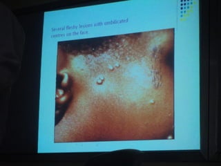 34. the dna viruses i