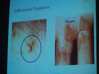 34. the dna viruses i