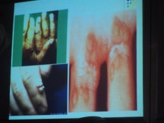 34. the dna viruses i