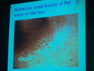 34. the dna viruses i