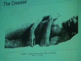 34. the dna viruses i