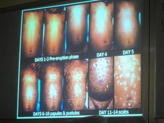 34. the dna viruses i