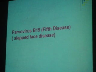 34. the dna viruses i