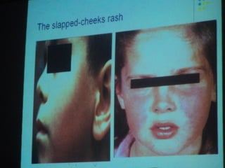 34. the dna viruses i