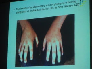 34. the dna viruses i