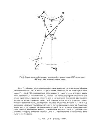 Рис.9. Схема движений клюшки, положений лучезапястного (ЛЗС) и плечевых
(ПС) суставов при совершении удара.
Сила Fr t действует перпендикулярно стержню клюшки и также вызывает действия
уравновешивающих сил в кистях и предплечьях. Проекция ее на левое предплечье
равна: Fr t · sin (α / 2) и направлена в проксимальную сторону, т. е. с стремится сжать
левое предплечье, а составляющая: Fr t · cos (α / 2), перпендикулярная продольной оси
левого предплечья стремится привести его в вертикальное положения. Для правого
предплечья соответствующие силы, действующие вдоль него и перпендикулярно,
равны по величине силам, действующим на левое предплечье. Но сила Fr t · sin (α / 2)
направлена в дистальную сторону и стремится растянуть правое предплечье. Поскольку
правая кисть, как правило, расположена ниже левой кисти, то две разнонаправленные
силы создают вращающий момент, стремящийся изогнуть кисти в лучезапястных
суставах в сторону движения клюшки. Сила Fr t пропорциональна отношению длин
рычагов l2 и l1 и равна:
Fr t = (l2 / l1) · m · g · cos γ0 · sin φ .
Copyright ОАО «ЦКБ «БИБКОМ» & ООО «Aгентство Kнига-Cервис»
 