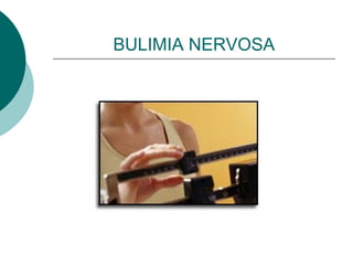 BULIMIA NERVOSA
 