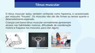 Tônus muscular
O tônus ​​muscular baixo, também conhecido como hipotonia, é caracterizado
por músculos "frouxos". Os músculos não são tão firmes ou tensos quanto o
desenvolvimento esperado.
© Stone/GettyImages © E+/GettyImages
Crianças com baixo tônus ​​muscular normalmente apresentam
atrasos nas habilidades motoras, dificuldade de coordenação
motora e fraqueza nos músculos, para citar alguns.
© iStock/GettyImages
 