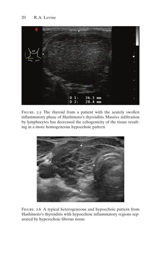 Thyroid And Parathyroid Ultrasound And Ultrasoundguided Fna 4th Edition ...