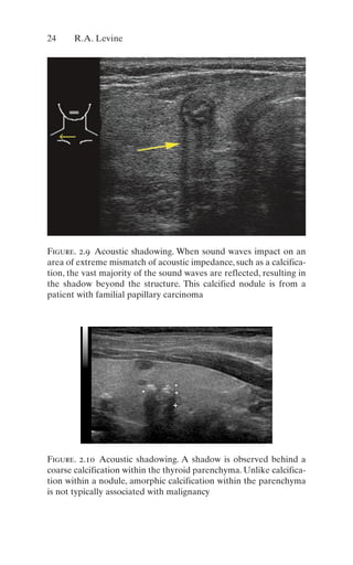 Thyroid And Parathyroid Ultrasound And Ultrasoundguided Fna 4th Edition ...