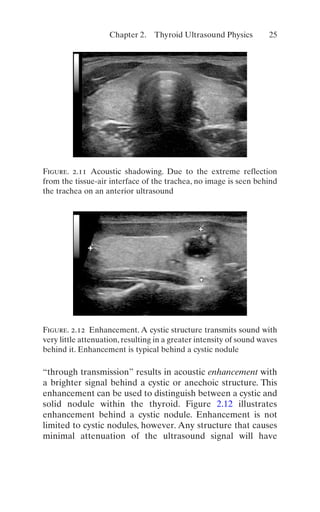 Thyroid And Parathyroid Ultrasound And Ultrasoundguided Fna 4th Edition ...