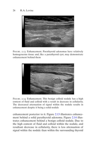 Thyroid And Parathyroid Ultrasound And Ultrasoundguided Fna 4th Edition ...