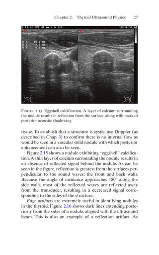 Thyroid And Parathyroid Ultrasound And Ultrasoundguided Fna 4th Edition ...