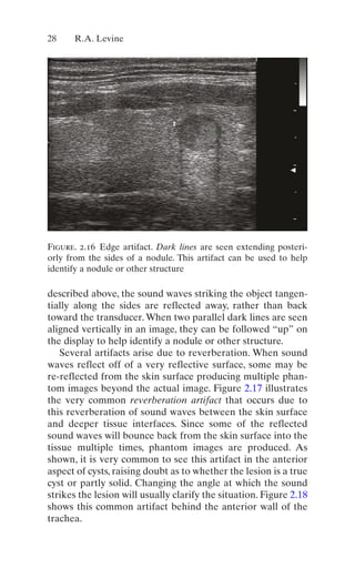 Thyroid And Parathyroid Ultrasound And Ultrasoundguided Fna 4th Edition ...