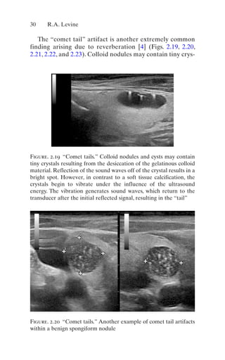 Thyroid And Parathyroid Ultrasound And Ultrasoundguided Fna 4th Edition ...