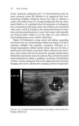 Thyroid And Parathyroid Ultrasound And Ultrasoundguided Fna 4th Edition ...