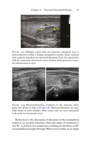 Thyroid And Parathyroid Ultrasound And Ultrasoundguided Fna 4th Edition ...