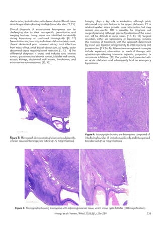 Acute Abdomen Caused by Torsion of a Giant Parasitic Ovarian Leiomyoma ...