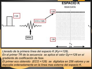Llenado de la primera línea del espacio K (Ky=+128). 
En el primer TR de la secuencia se aplica el valor Gy=+128 en el 
gradiente de codificación de fase. 
El primer eco obtenido (ECO +128) se digitaliza en 256 valores y se 
deposita ordenadamente en la línea mas externa del espacio K. 
 
