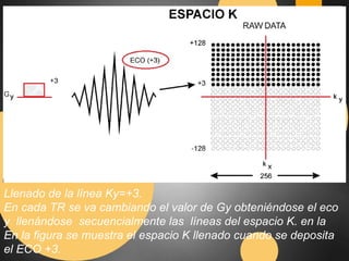 Llenado de la línea Ky=+3. 
En cada TR se va cambiando el valor de Gy obteniéndose el eco 
y llenándose secuencialmente las líneas del espacio K. en la 
En la figura se muestra el espacio K llenado cuando se deposita 
el ECO +3. 
 