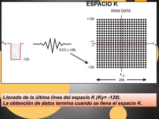 Llenado de la última línea del espacio K (Ky= -128). 
La obtención de datos termina cuando se llena el espacio K. 
 
