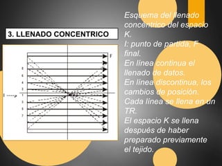 3. LLENADO CONCENTRICO 
Esquema del llenado 
concéntrico del espacio 
K. 
I: punto de partida, F 
final. 
En línea continua el 
llenado de datos. 
En línea discontinua, los 
cambios de posición. 
Cada línea se llena en un 
TR. 
El espacio K se llena 
después de haber 
preparado previamente 
el tejido. 
 