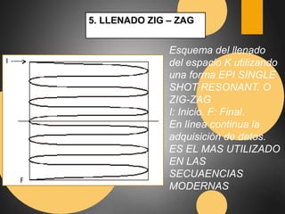 5. LLENADO ZIG – ZAG 
Esquema del llenado 
del espacio K utilizando 
una forma EPI SINGLE 
SHOT RESONANT. O 
ZIG-ZAG 
I: Inicio. F: Final. 
En línea continua la 
adquisición de datos. 
ES EL MAS UTILIZADO 
EN LAS 
SECUAENCIAS 
MODERNAS 
 