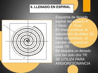 6. LLENADO EN ESPIRAL 
Esquema de llenado 
espiral del espacio K. 
I: Inicio . F: Final. 
En línea continua: la 
adquisición de datos. En 
línea discontinua , el 
cambio de espiral en 
cada TR. 
Se muestra un llenado 
con tan solo dos TR. 
SE UTILIZA PARA 
ANGIORESONANCIA 
 