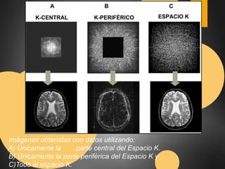 A B C 
K-CENTRAL K-PERIFÉRICO ESPACIO K 
Imágenes obtenidas con datos utilizando: 
A) Únicamente la parte central del Espacio K. 
B) Únicamente la parte periférica del Espacio K y 
C)Todo el espacio K. 
 