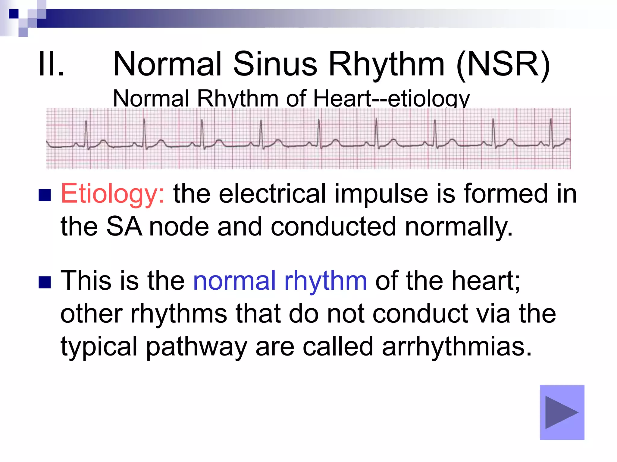 II. Normal Sinus Rhythm (NSR)
Normal Rhythm of Heart--etiology
 Etiology: the electrical impulse is formed in
the SA node and conducted normally.
 This is the normal rhythm of the heart;
other rhythms that do not conduct via the
typical pathway are called arrhythmias.
 