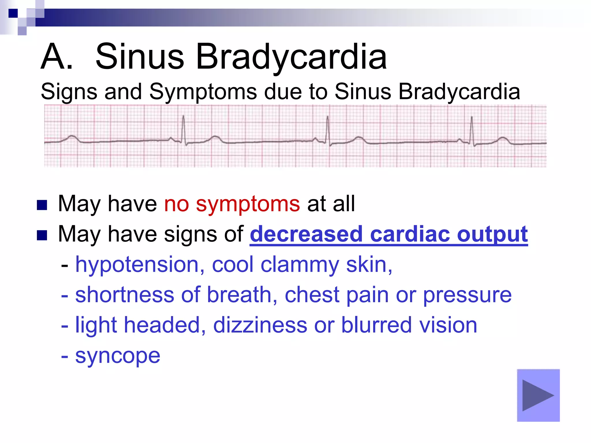 A. Sinus Bradycardia
Signs and Symptoms due to Sinus Bradycardia
 May have no symptoms at all
 May have signs of decreased cardiac output
- hypotension, cool clammy skin,
- shortness of breath, chest pain or pressure
- light headed, dizziness or blurred vision
- syncope
 