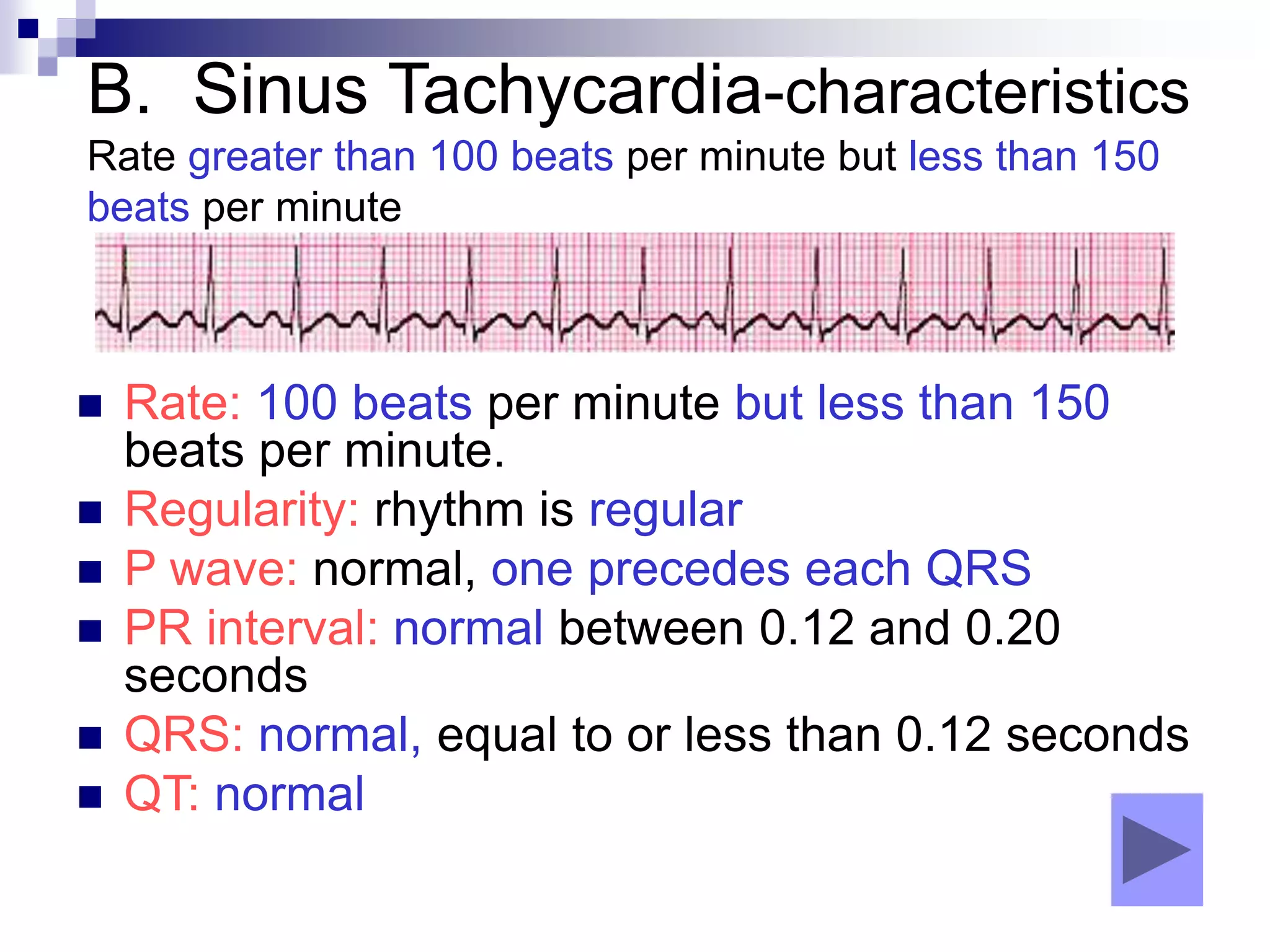 B. Sinus Tachycardia-characteristics
Rate greater than 100 beats per minute but less than 150
beats per minute
 Rate: 100 beats per minute but less than 150
beats per minute.
 Regularity: rhythm is regular
 P wave: normal, one precedes each QRS
 PR interval: normal between 0.12 and 0.20
seconds
 QRS: normal, equal to or less than 0.12 seconds
 QT: normal
 