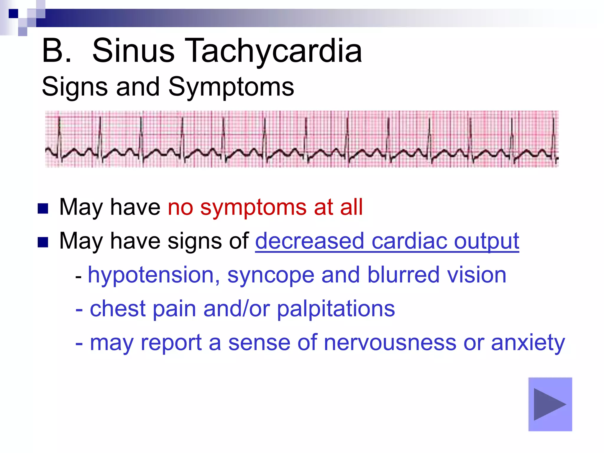 B. Sinus Tachycardia
Signs and Symptoms
 May have no symptoms at all
 May have signs of decreased cardiac output
- hypotension, syncope and blurred vision
- chest pain and/or palpitations
- may report a sense of nervousness or anxiety
 