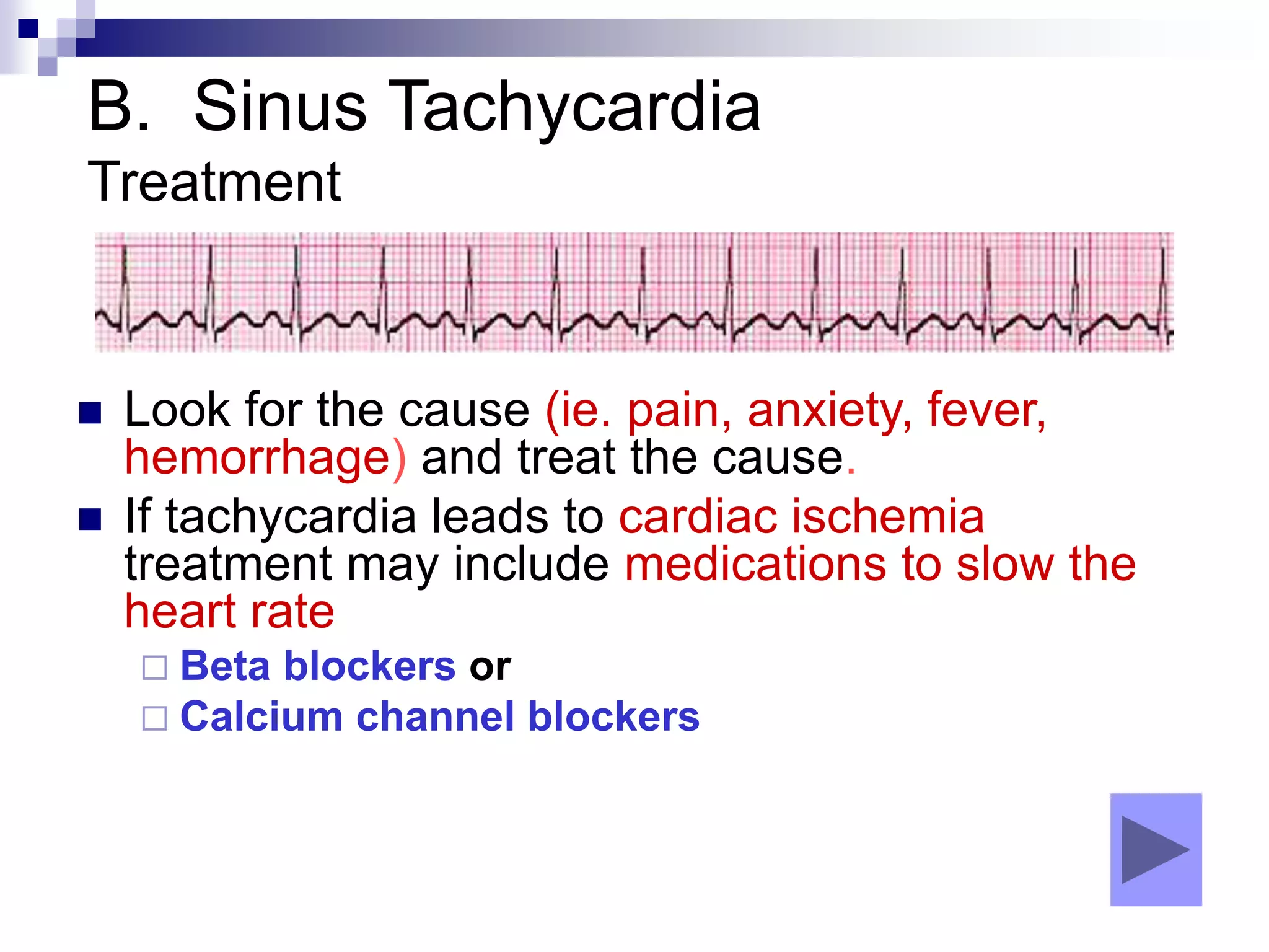 B. Sinus Tachycardia
Treatment
 Look for the cause (ie. pain, anxiety, fever,
hemorrhage) and treat the cause.
 If tachycardia leads to cardiac ischemia
treatment may include medications to slow the
heart rate
 Beta blockers or
 Calcium channel blockers
 