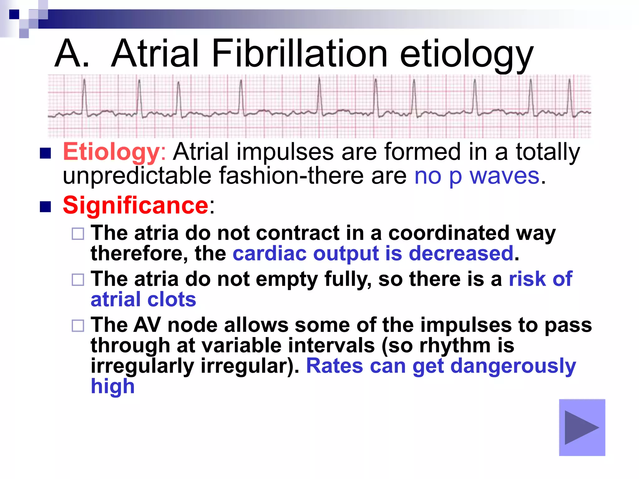 A. Atrial Fibrillation etiology
 Etiology: Atrial impulses are formed in a totally
unpredictable fashion-there are no p waves.
 Significance:
 The atria do not contract in a coordinated way
therefore, the cardiac output is decreased.
 The atria do not empty fully, so there is a risk of
atrial clots
 The AV node allows some of the impulses to pass
through at variable intervals (so rhythm is
irregularly irregular). Rates can get dangerously
high
 