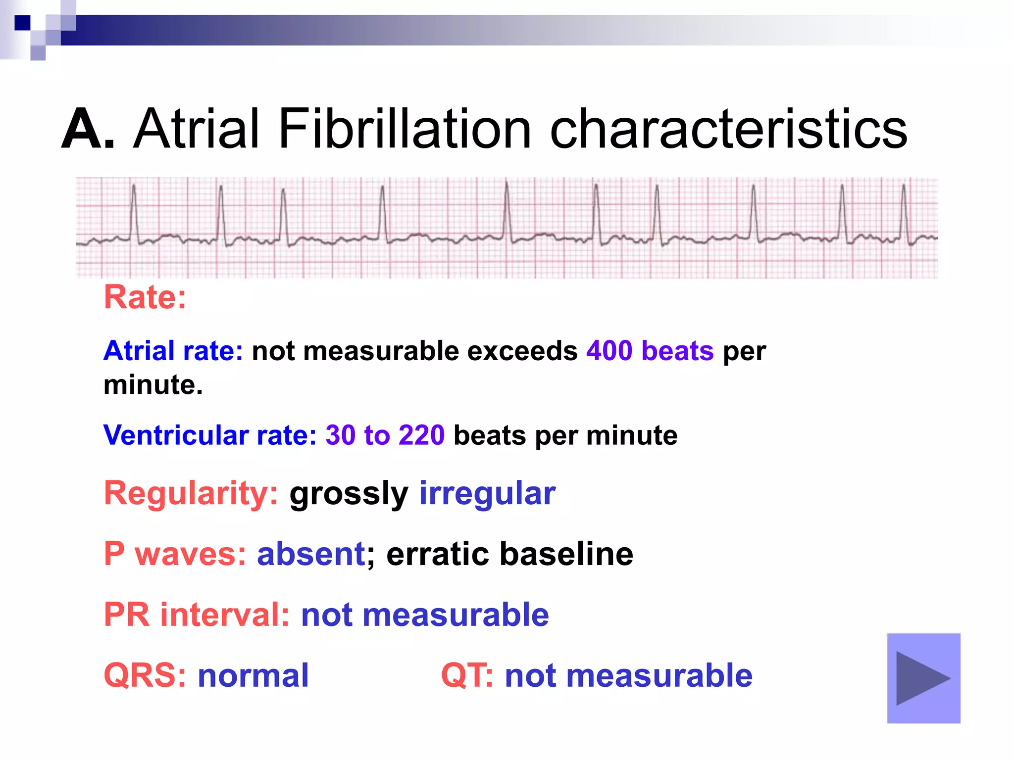 A. Atrial Fibrillation characteristics
Rate:
Atrial rate: not measurable exceeds 400 beats per
minute.
Ventricular rate: 30 to 220 beats per minute
Regularity: grossly irregular
P waves: absent; erratic baseline
PR interval: not measurable
QRS: normal QT: not measurable
 