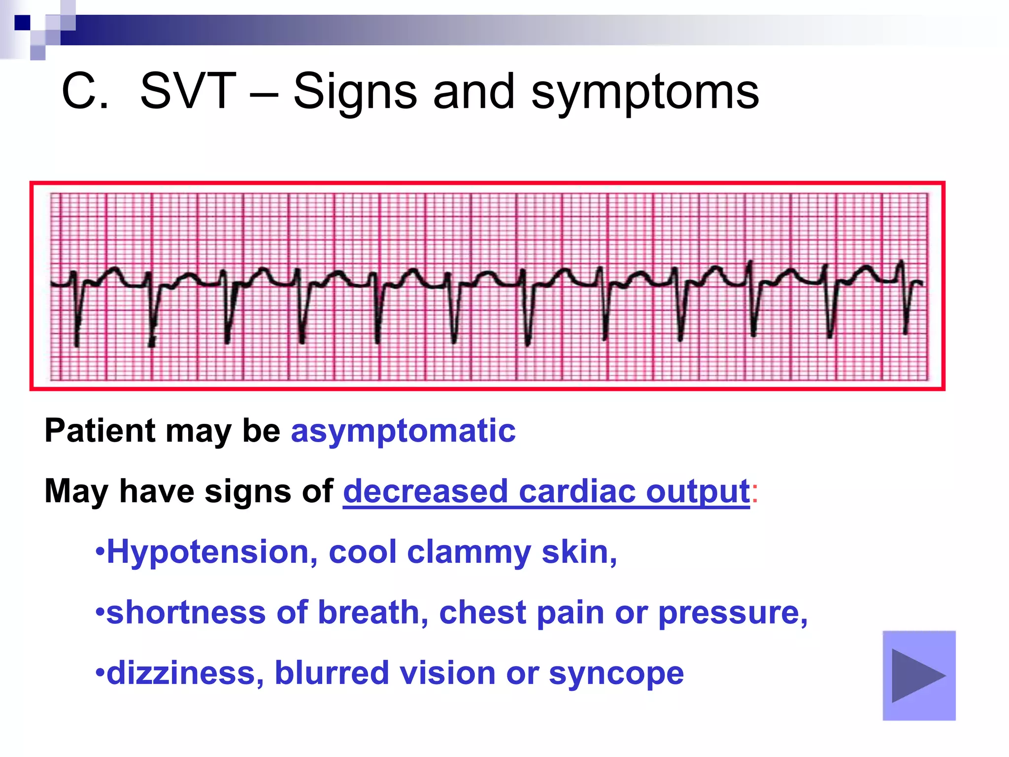 C. SVT – Signs and symptoms
Patient may be asymptomatic
May have signs of decreased cardiac output:
•Hypotension, cool clammy skin,
•shortness of breath, chest pain or pressure,
•dizziness, blurred vision or syncope
 