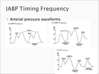 Arterial pressure waveforms 