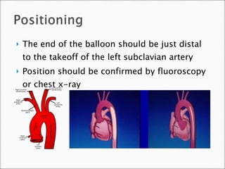 The end of the balloon should be just distal to the takeoff of the left subclavian artery Position should be confirmed by fluoroscopy or chest x-ray 