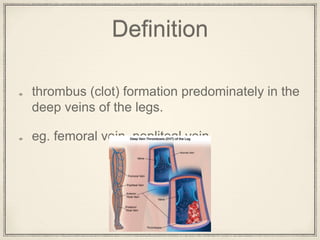 Dvt Prophylaxis