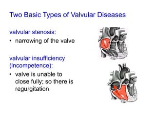 learning_heart_sounds_&_murmurs download.ppt
