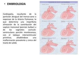Cardiopatia, resultante de la
partición desigual del tronco-cono a
expensas de la Arteria Pulmonar, lo
que determina una imperfecta
alineación de la contribución del
septùm tronconal (porcion bulbar) y
de los coginetes auriculo-
ventriculares porción membranosa,
con el tabique interventricular
primitivo; añadiéndose una
malformación prevalente y única del
tracto de salida
• EMBRIOLOGIA
 
