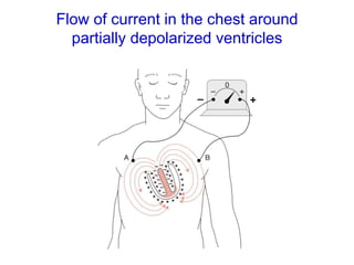 Flow of current in the chest around
partially depolarized ventricles
 