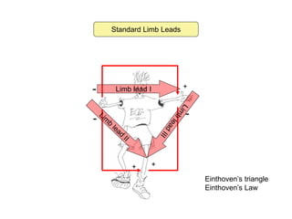 Standard Limb Leads
- +
Limb lead I
-
+ +
-
Einthoven’s triangle
Einthoven’s Law
 